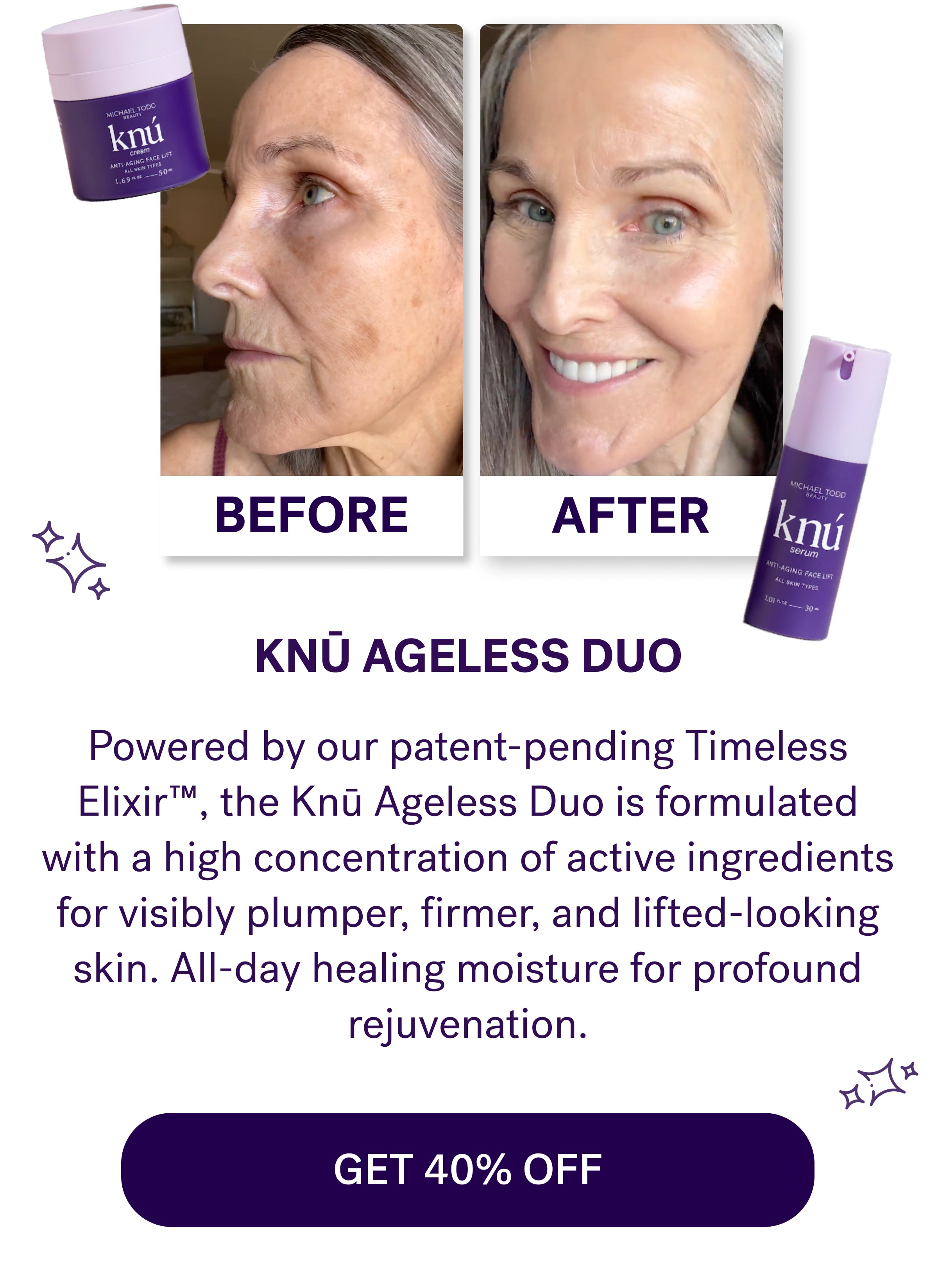 Before AFTER Knū Ageless Duo Powered by our patent-pending Timeless Elixir™, the Knū Ageless Duo is formulated with a high concentration of active ingredients for visibly plumper, firmer, and lifted-looking skin. All-day healing moisture for profound rejuvenation. GET 40% OFF
