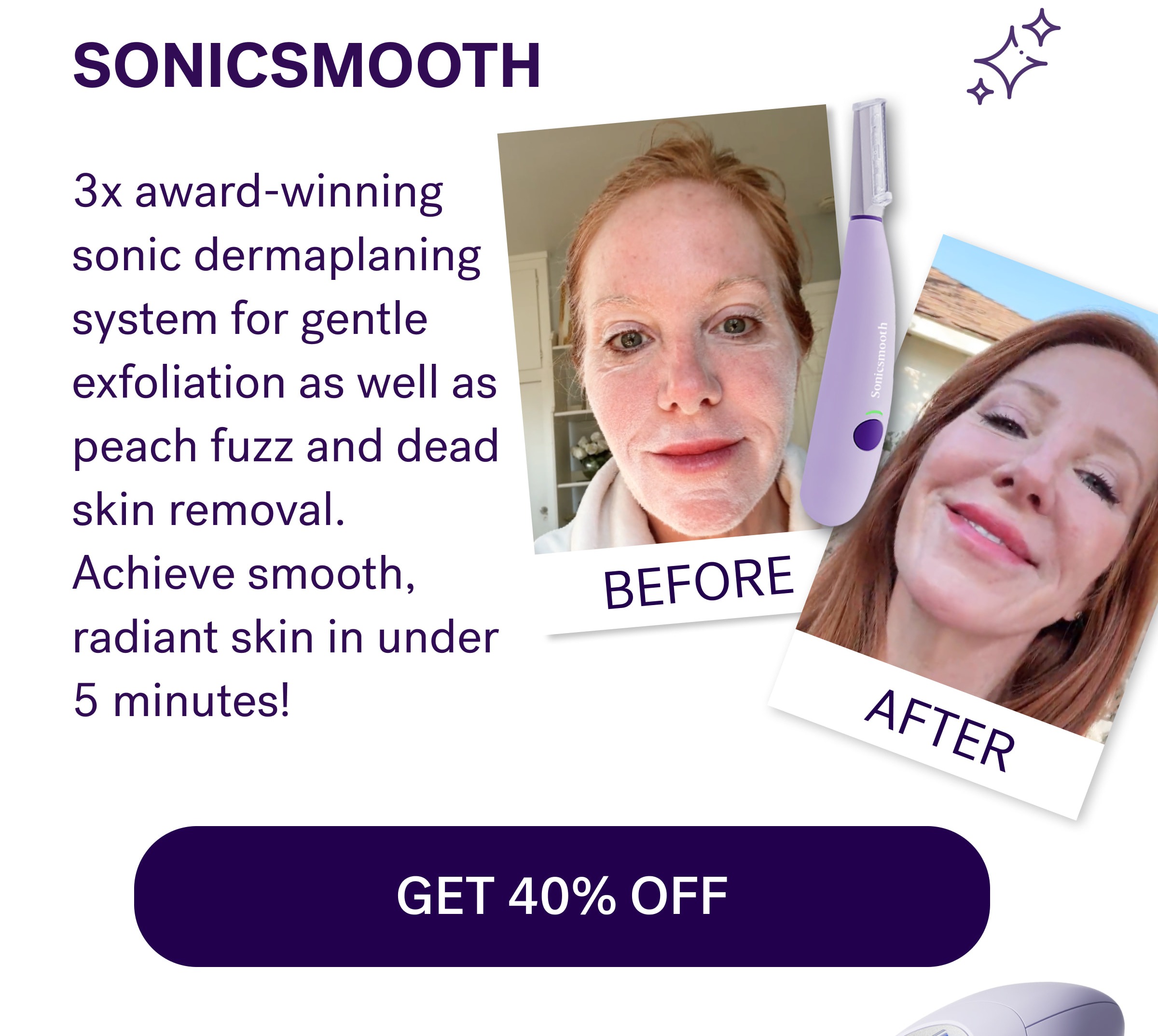 SONICSMOOTH 3x award-winning sonic dermaplaning system for gentle exfoliation as well as peach fuzz and dead skin removal. Achieve smooth, radiant skin in under 5 minutes! GET 40% OFF