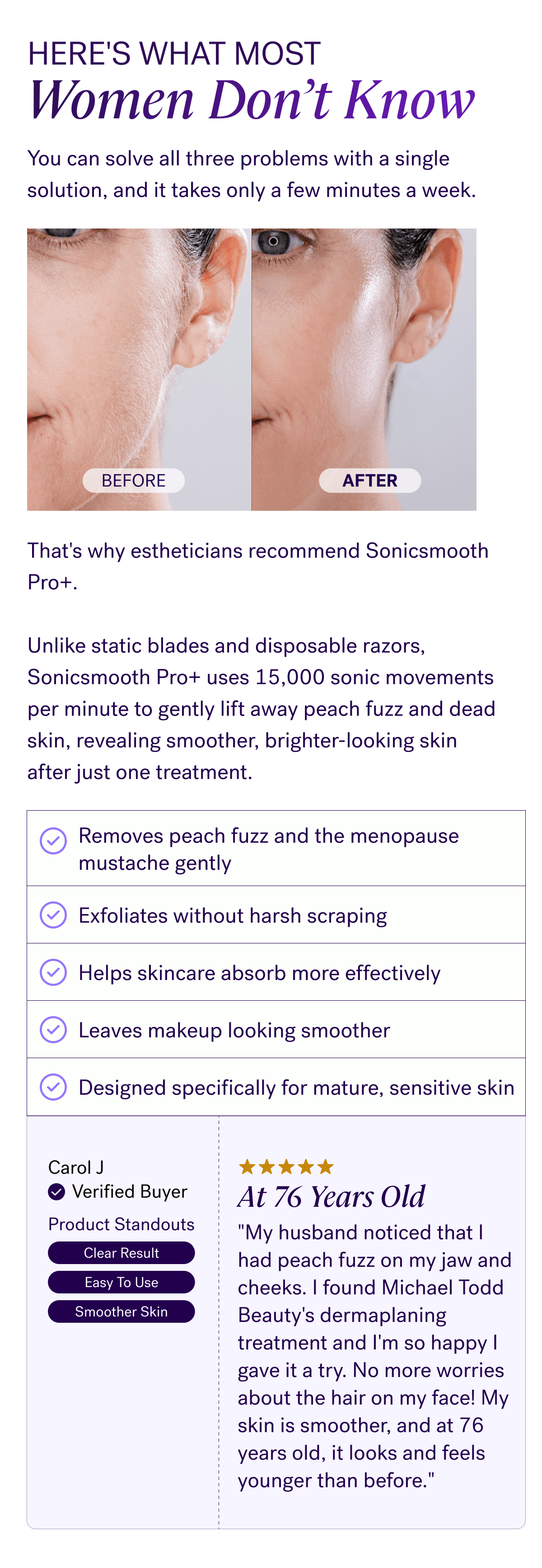 Here's What Most Women Don’t Know You can solve all three problems with a single solution, and it takes only a few minutes a week. BEFORE AFTER That's why estheticians recommend Sonicsmooth Pro+.  Unlike static blades and disposable razors, Sonicsmooth Pro+ uses 15,000 sonic movements per minute to gently lift away peach fuzz and dead skin, revealing smoother, brighter-looking skin after just one treatment. Removes peach fuzz and the menopause mustache gently Exfoliates without harsh scraping Helps skincare absorb more effectively Leaves makeup looking smoother Designed specifically for mature, sensitive skin Carol J Verified Buyer At 76 Years Old Product Standouts "My husband noticed that I had peach fuzz on my jaw and cheeks. I found Michael Todd Beauty's dermaplaning treatment and I'm so happy I gave it a try. No more worries about the hair on my face! My skin is smoother, and at 76 years old, it looks and feels younger than before." Clear Result Easy To Use Smoother Skin
