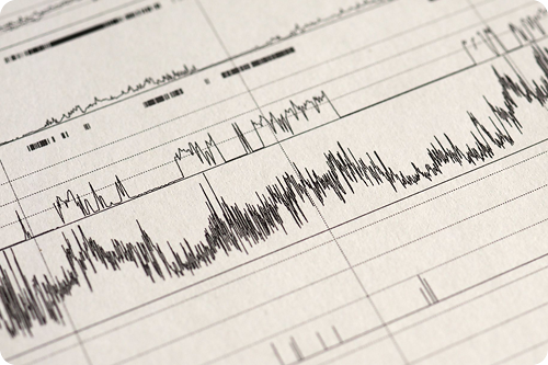 What is a Sleep Study?