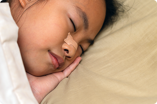 Snoring Strips: Do They Work?