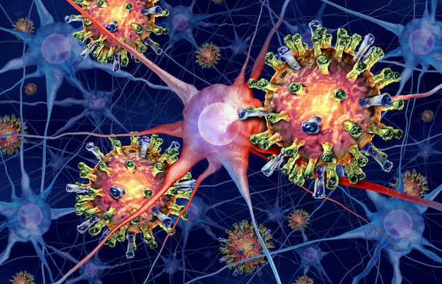 An illustration of measles virus particles attacking neurons.
