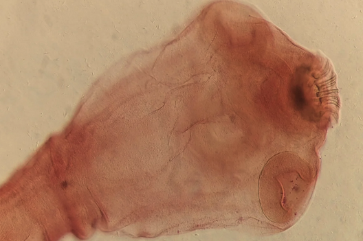 A microscopy image of a taenia solium tapeworm