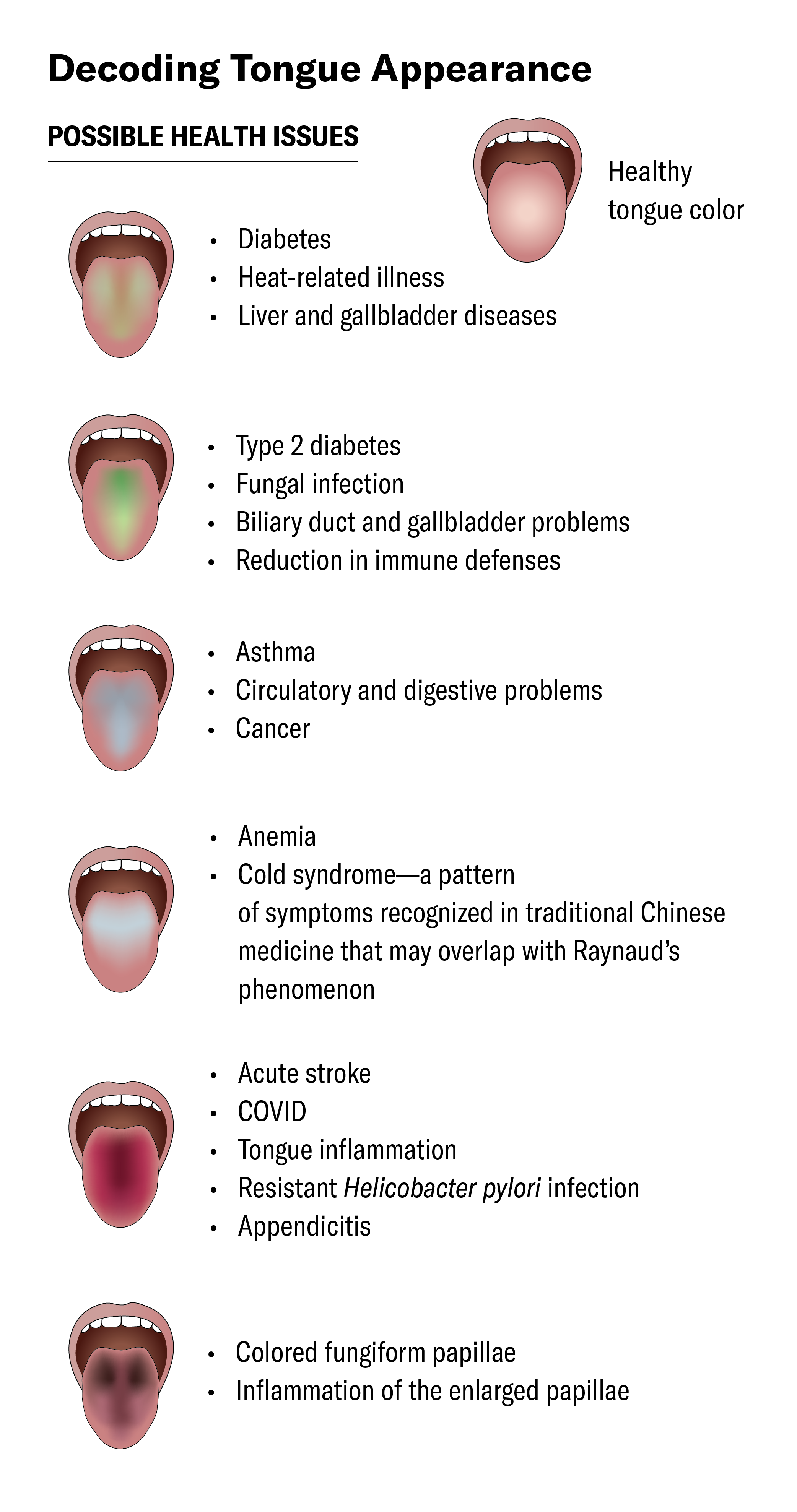 Graphic shows seven versions of an open mouth with tongue sticking out to show its color. One is pink (healthy color) and the others are tinted yellow, green, white, blue, red, and black, respectively. Labels list potential health issues associated with each color.