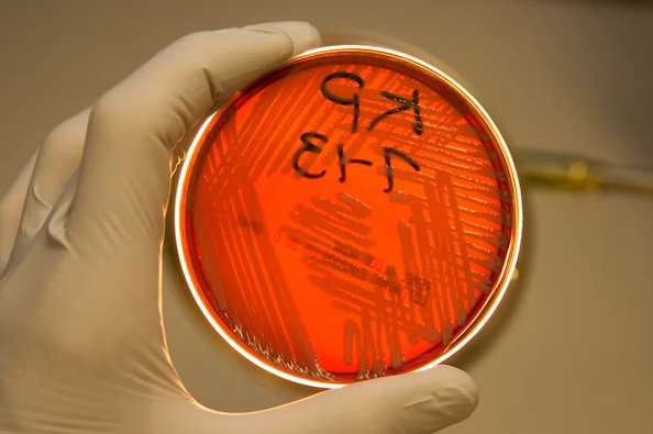 Gloved hand holding petri dish
