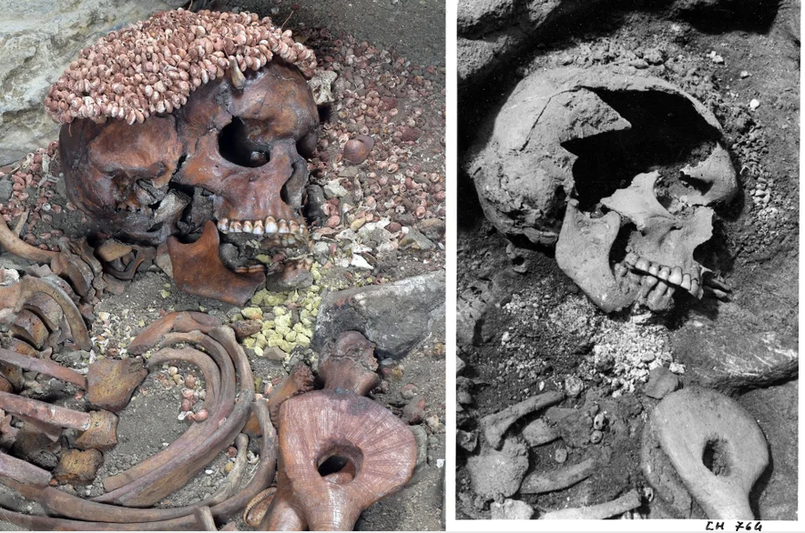 Side-by-side images of a skull and skeletal torso. The left image is in color and shows a cap on the skull made from small shells. The right image is black and white and shows a large hold in the skull