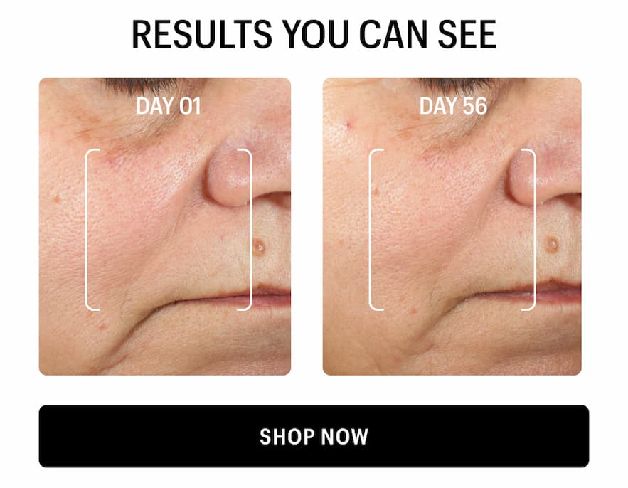 RESULTS YOU CAN SEE - Shop Now 