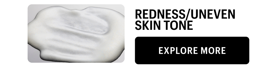 REDNESS & UNEVEN SKIN TONE - EXPLORE MORE