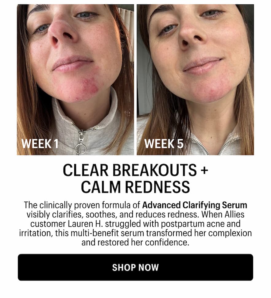 CLEAR BREAKOUTS + CALM REDNESS - Shop Now