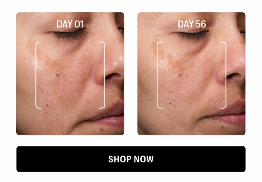 BEFORE & AFTER - Shop Now