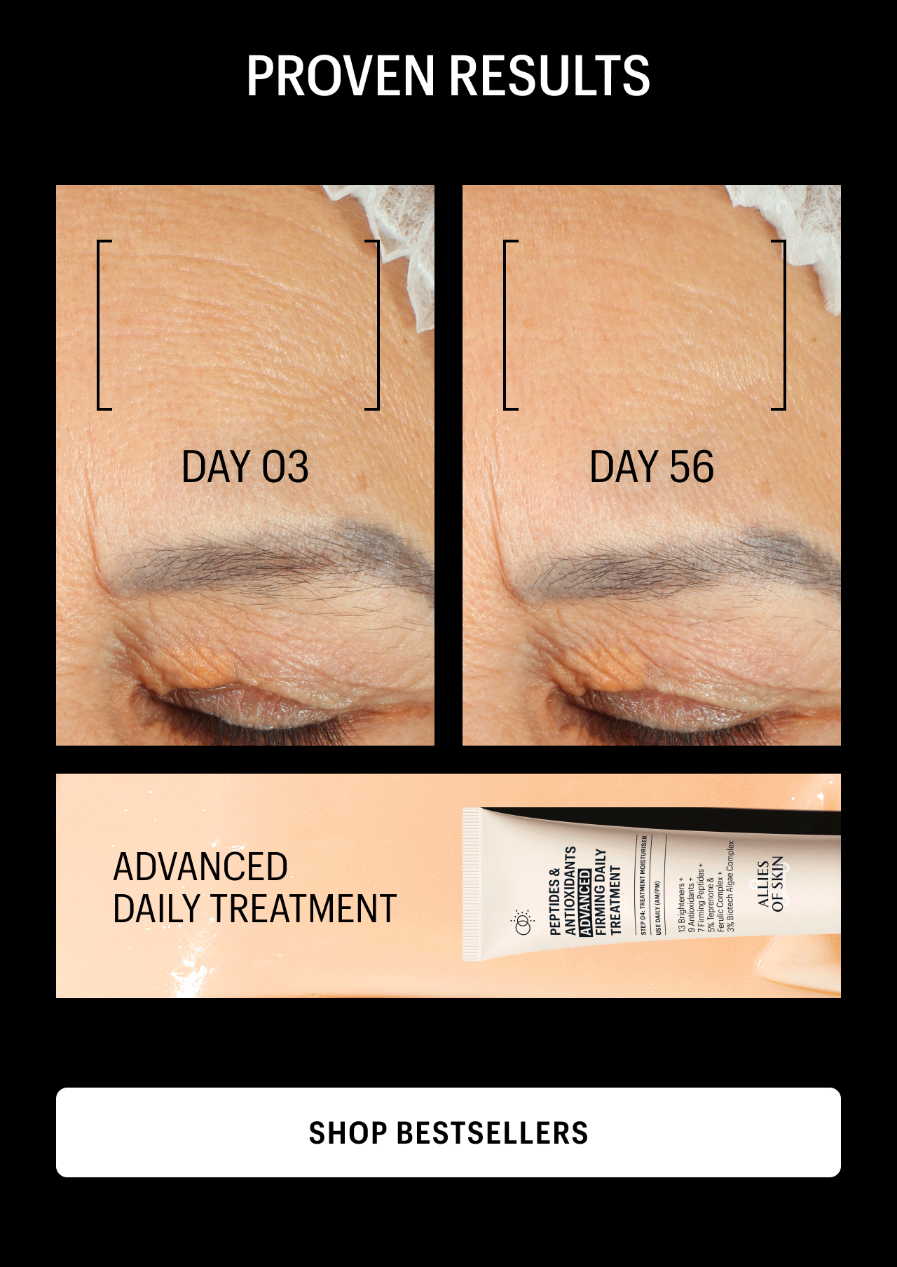 REAL LIFTING RESILTS | advanced daily treament | Shop Bestsellers