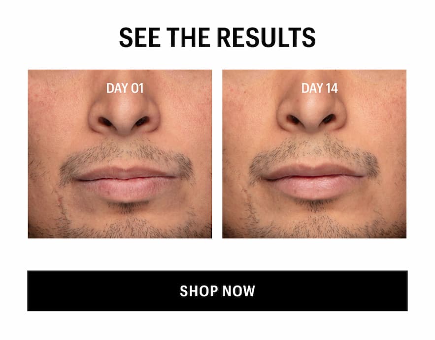 SEE THE RESULTS - Shop Now