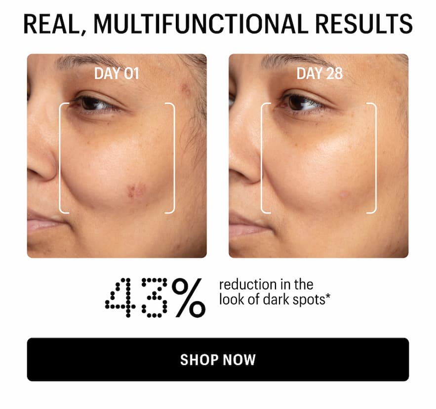 43% REDUCTION IN THE LOOK OF DARK SPOTS - Shop Now