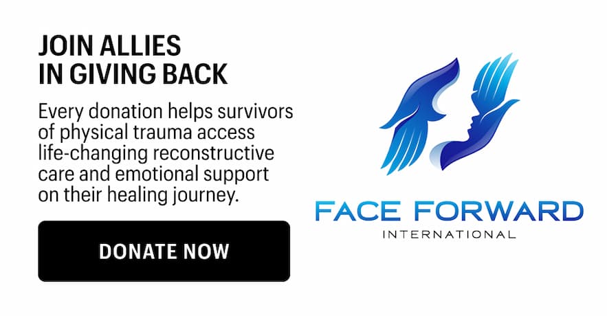 JOIN ALLIES IN GIVING BACK - Donate Now 