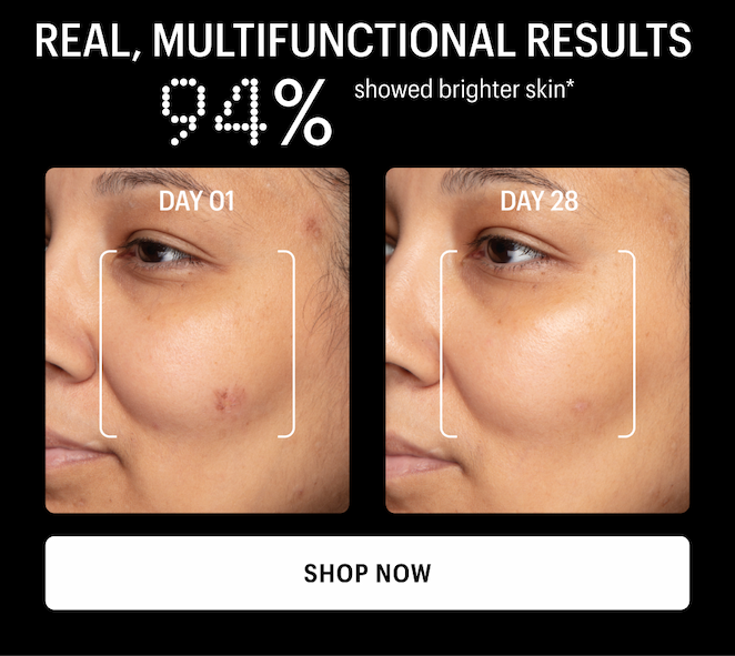 94% SHOWED BRIGHTER SKIN - Shop Now