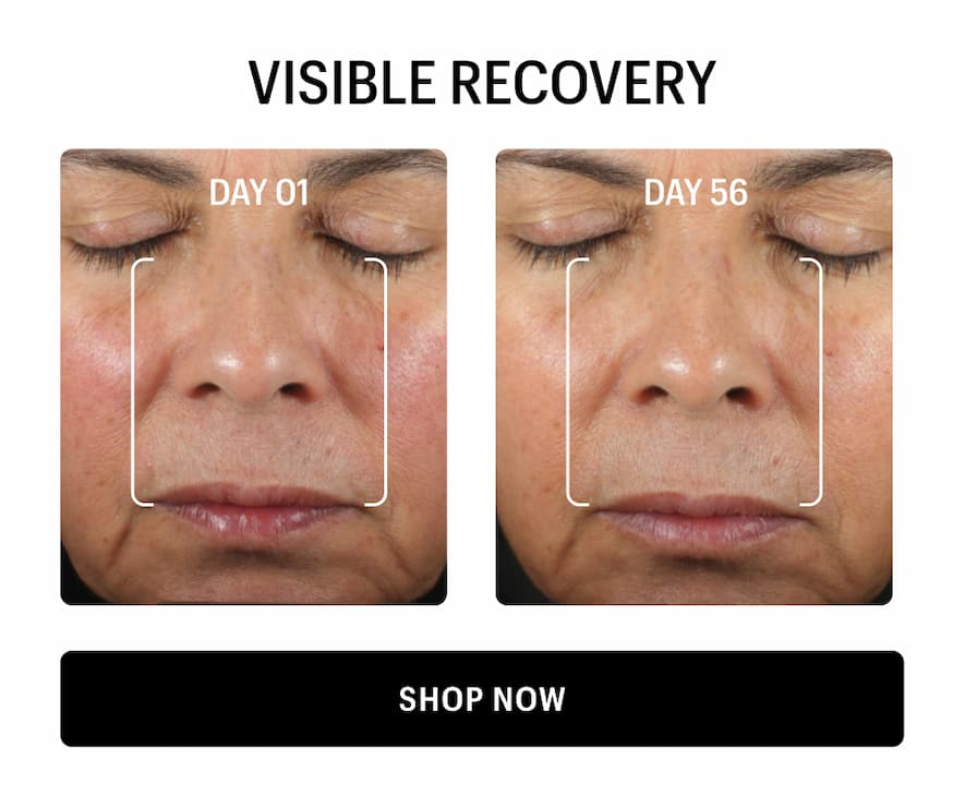VISIBLE RECOVERY - Shop Now 