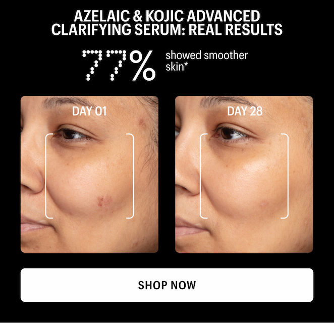 77% SHOWED SMOOTHER SKIN - Shop Now