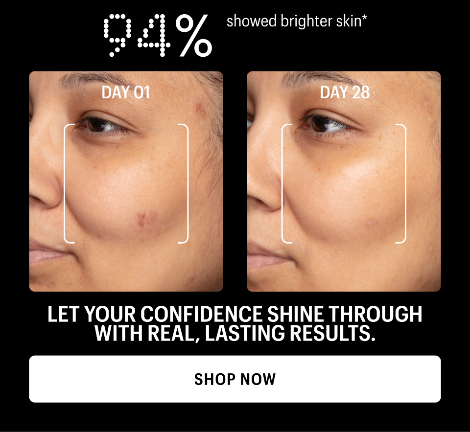 94% SHOWED BRIGHTER SKIN - Shop Now