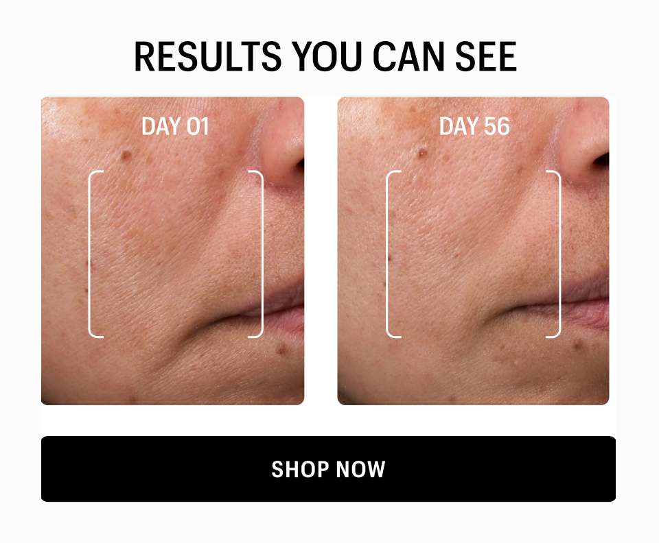 RESULTS YOU CAN SEE - Shop Now