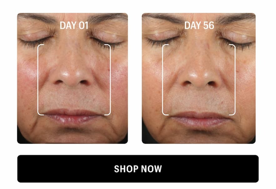 BEFORE & AFTER - Shop Now