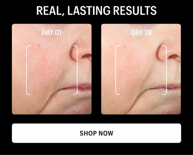 REAL LASTING RESULTS - Shop Now
