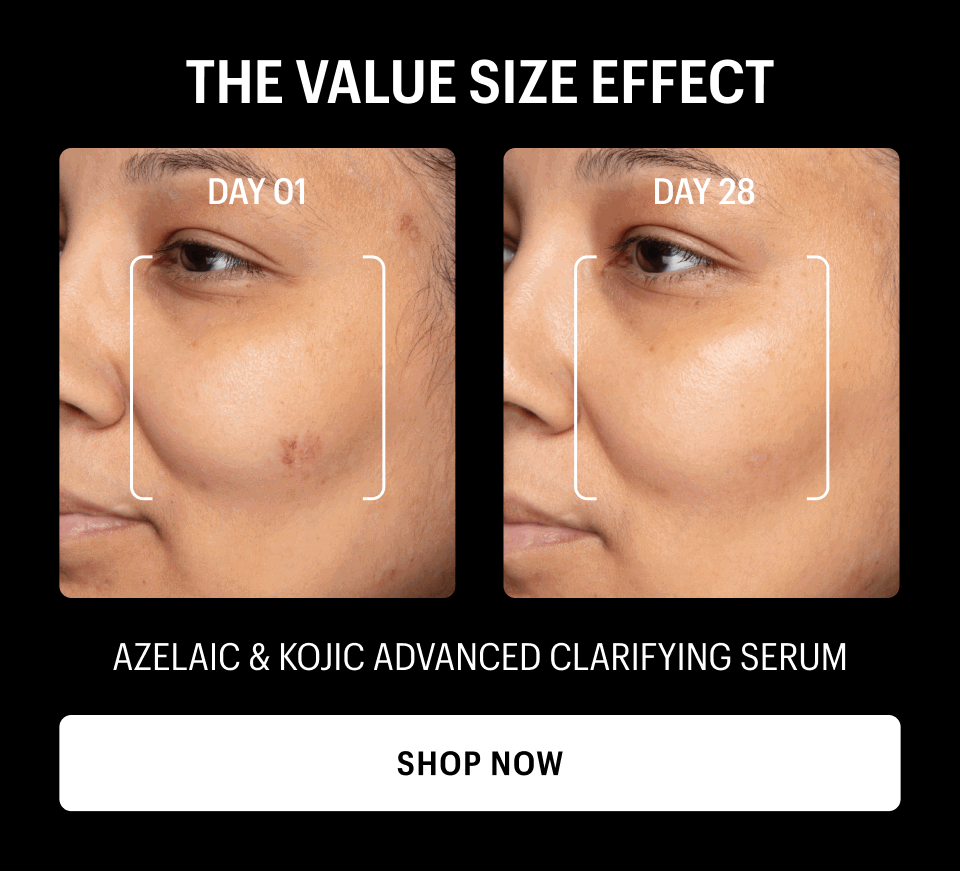 BEFORE & AFTER - Shop Now