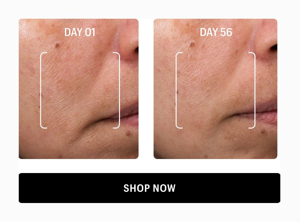 BEFORE AND AFTER- Shop Now