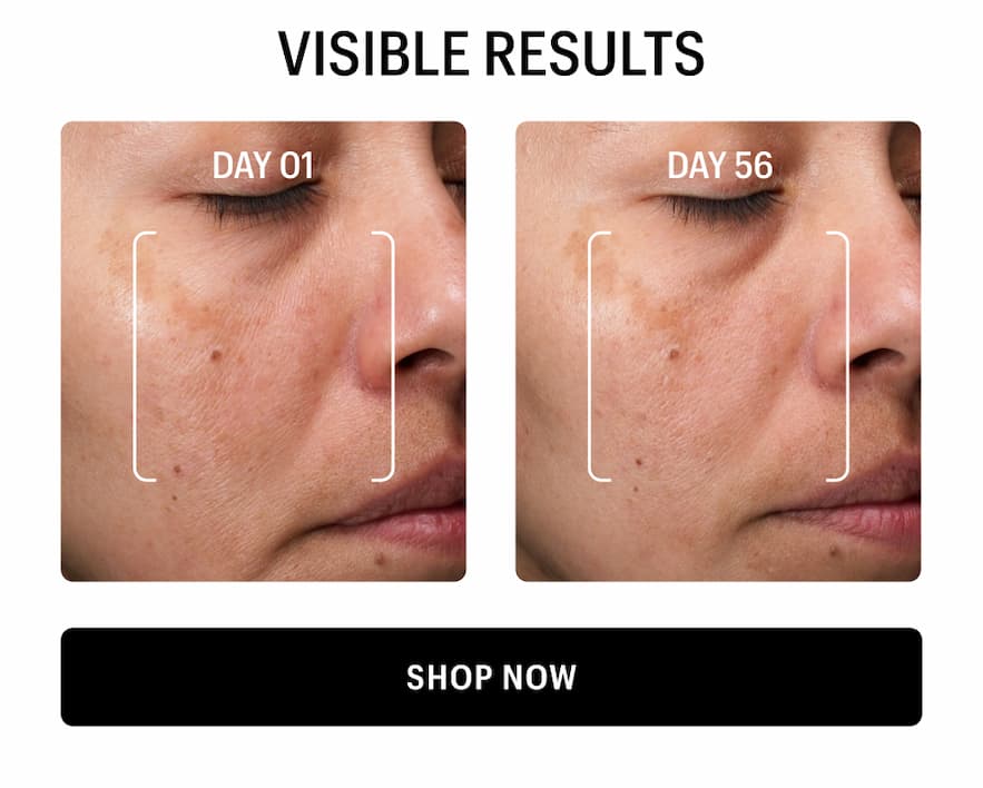 VISIBLE RESULTS - Shop Now