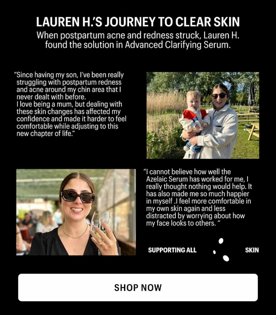 LAUREN H'S JOURNEY TO CLEAR SKIN - Shop Now