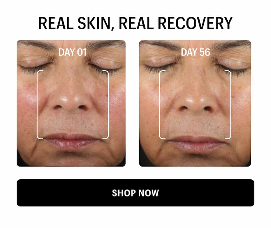 REAL SKIN, REAL RECOVERY - Shop Now