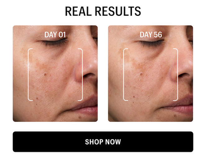 REAL RESULTS - Shop Now