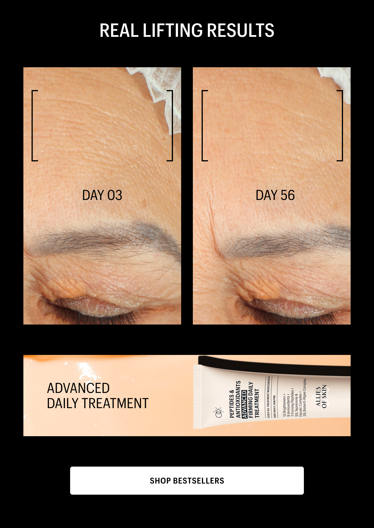 REAL LIFTING RESILTS | advanced daily treament | Shop Bestsellers