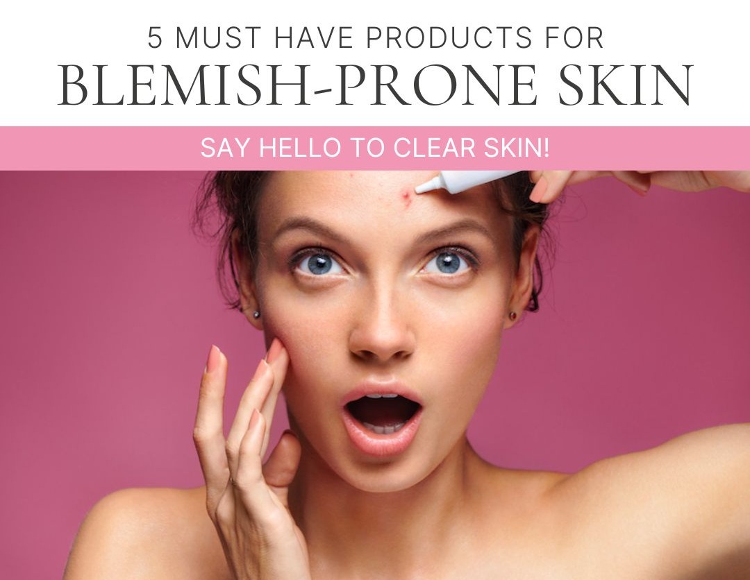 5 Must Have Products for BlemishProne Skin 🙌 Skin Shop
