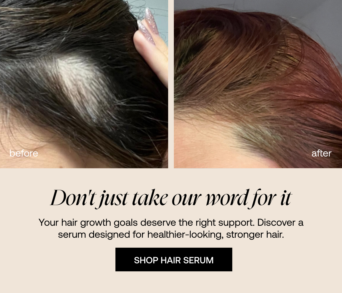 Before and After Hair Serum 