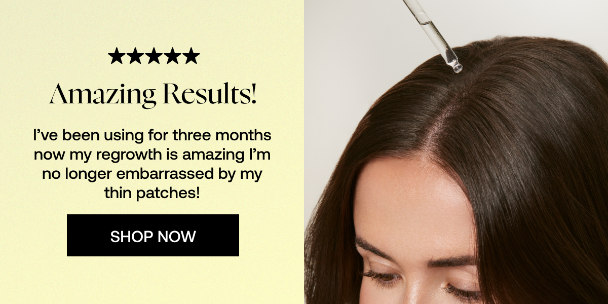 I’ve been using for three months now my regrowth is amazing I’m no longer embarrassed by my thin patches!