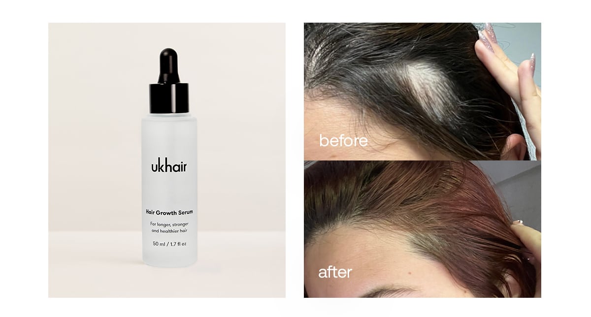 Hair Growth Serum