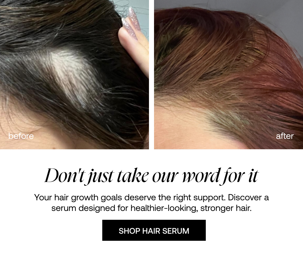Hair Growth Serum