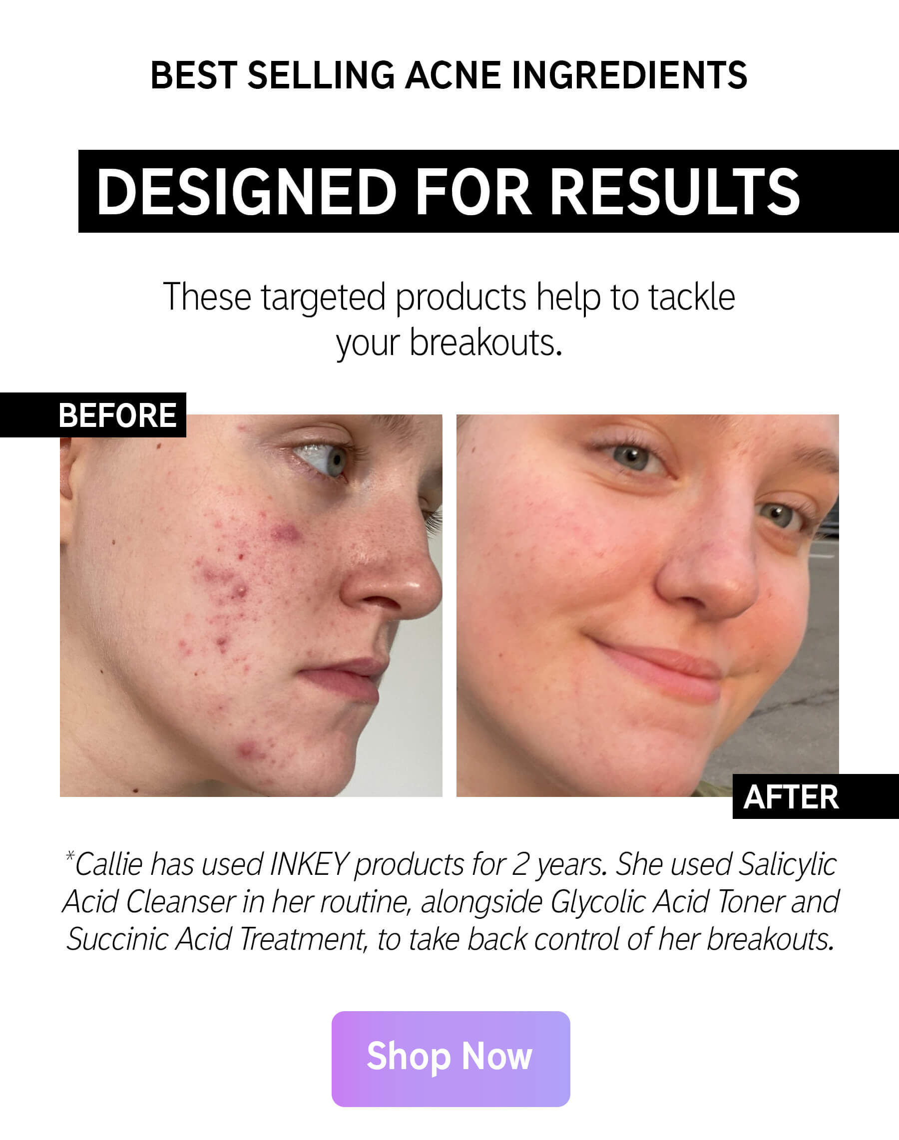 An easy, effective acne recipe 🌟 The Inkey List