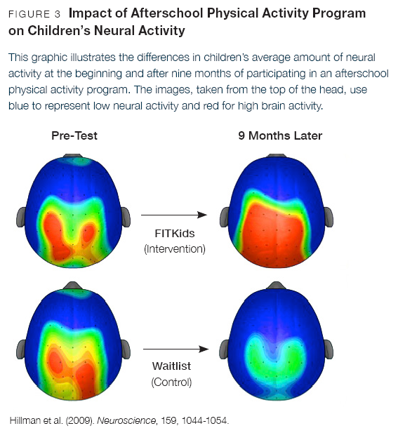 Image of brain scans from being sediment vs walking