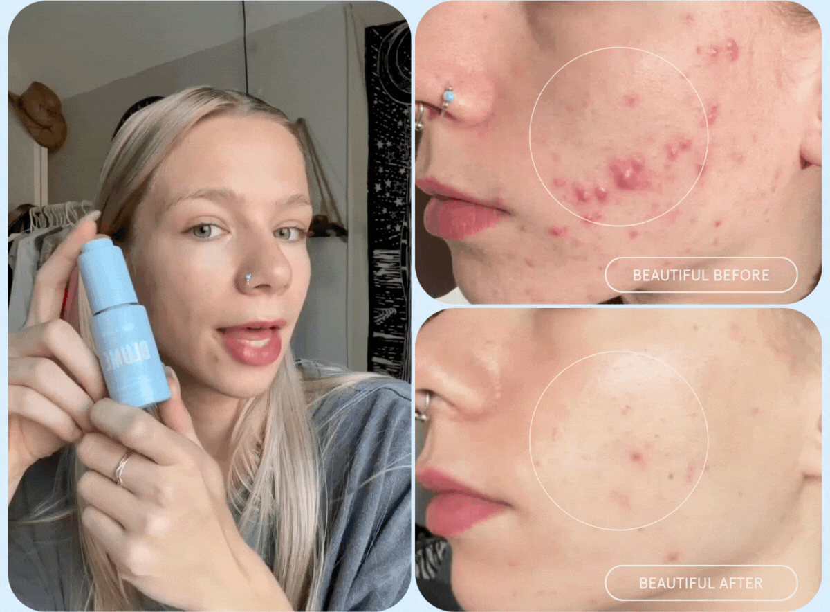 Beautiful Before & After