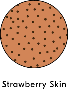 Strawberry Skin