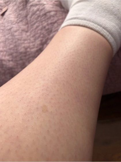 Lower Leg