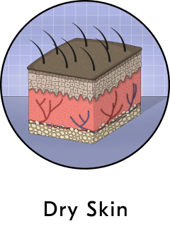 Dry Skin