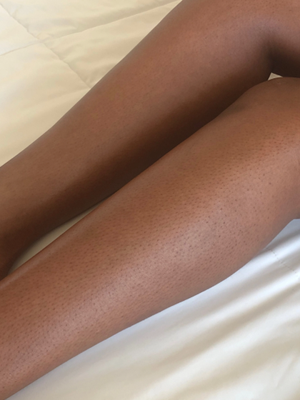 Lower Leg