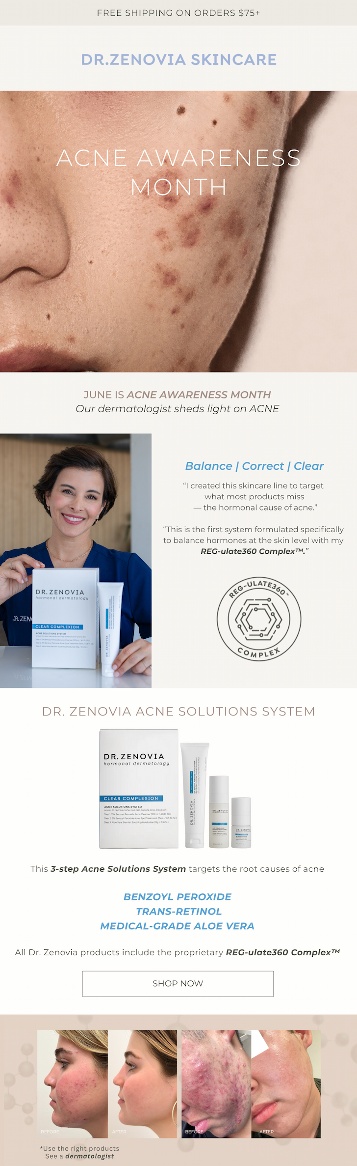 Acne Solutions System