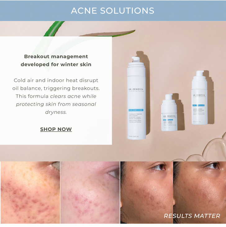 Acne Solutions