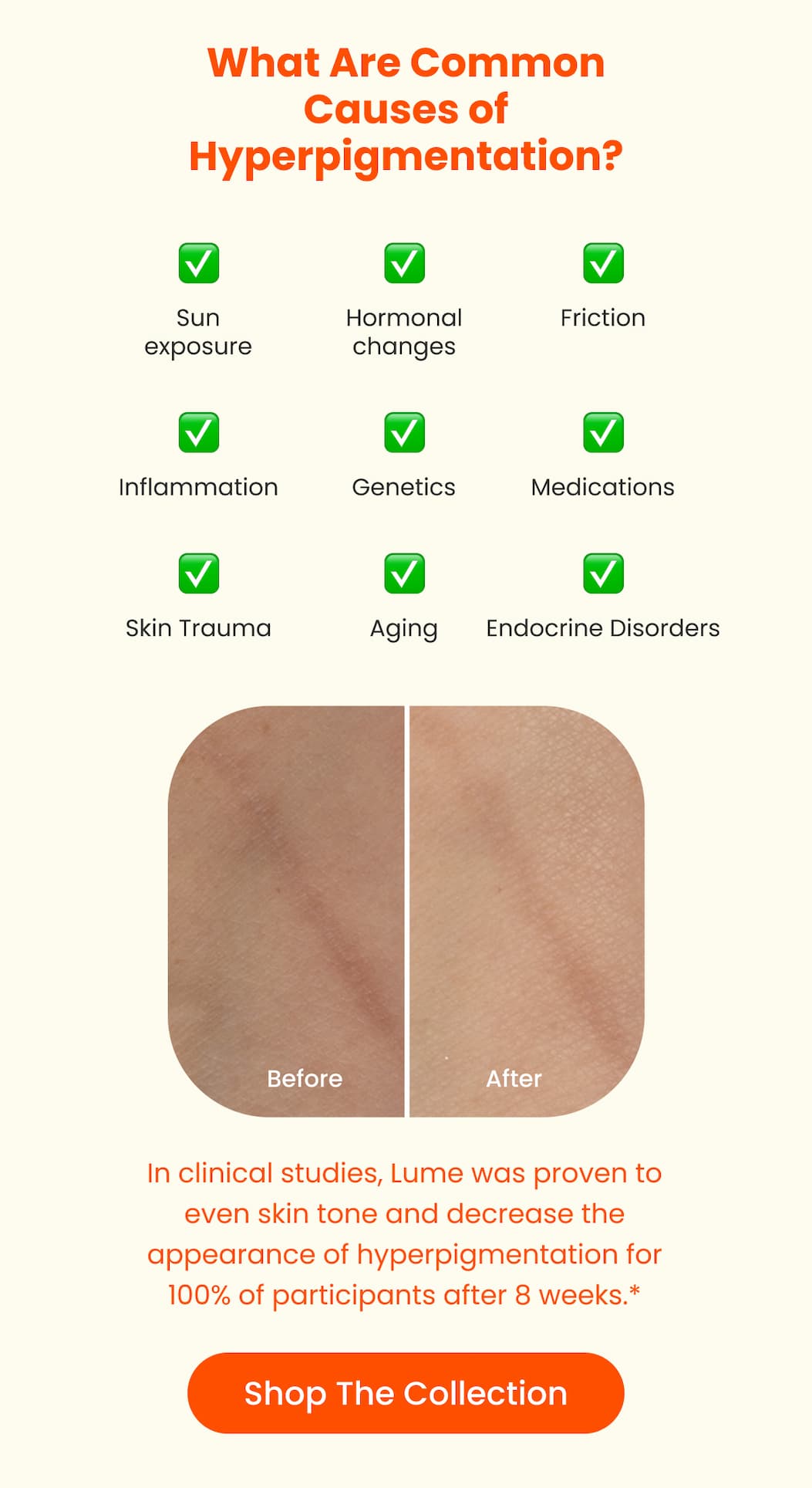 What are common causes of hyperpigmentation?