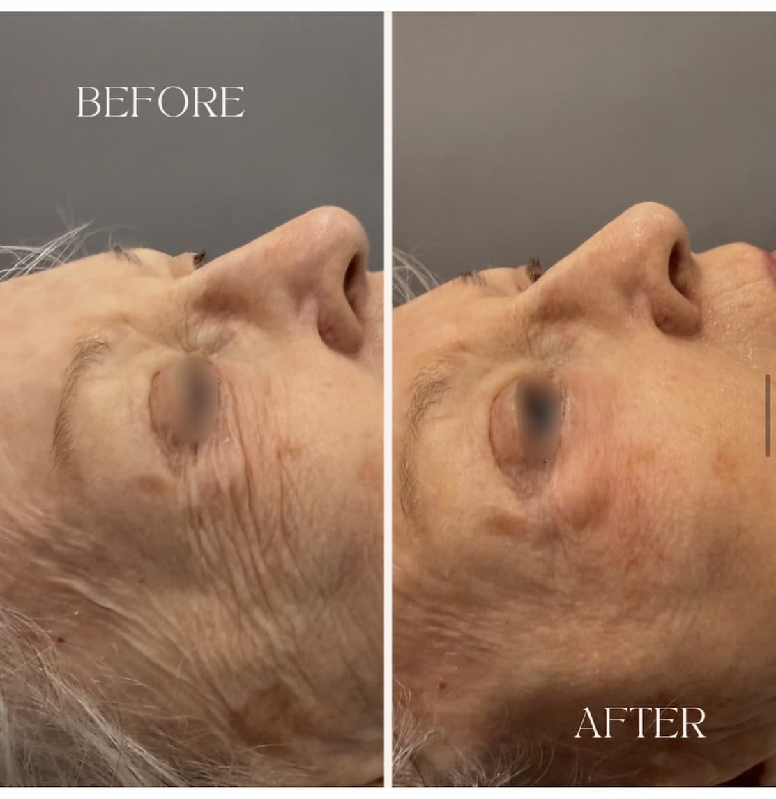 Ultimate Winter Makeover before and after