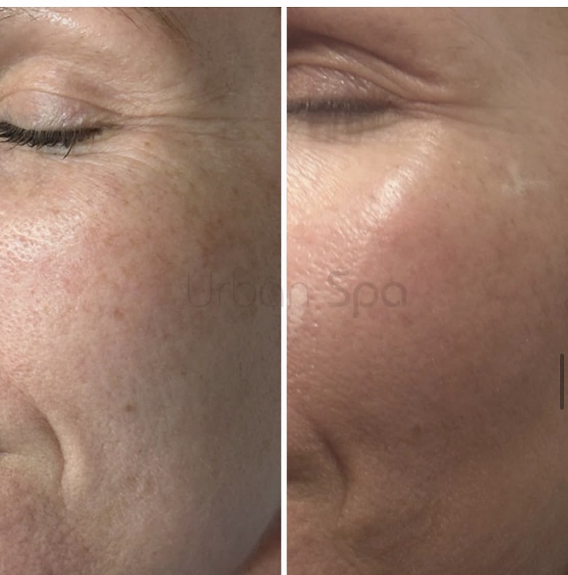 Winter Glow Makeover before and after