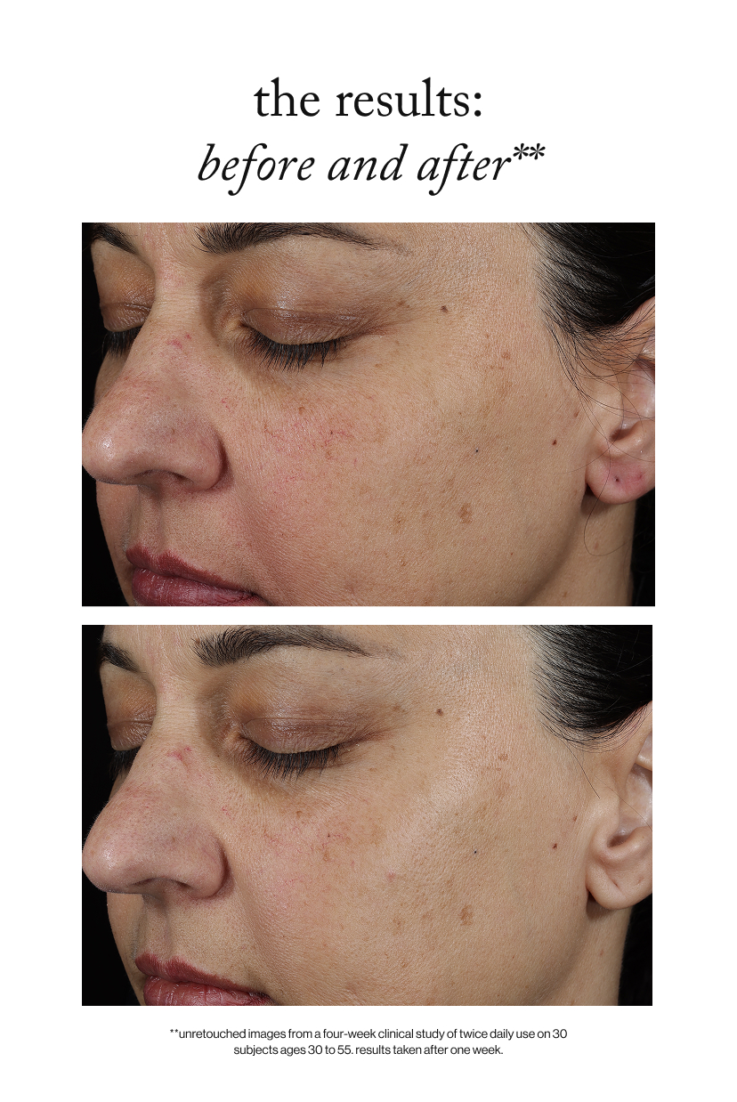 the results: before and after**